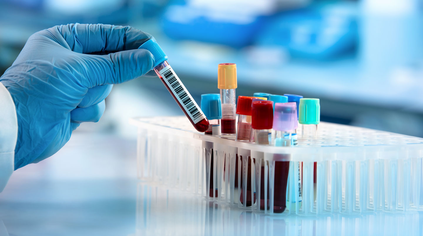 Technicien de laboratoire comparant un bidon de produit chimique dangereux (étiquetage SGH) avec une fiche technique de produit de substitution moins nocif